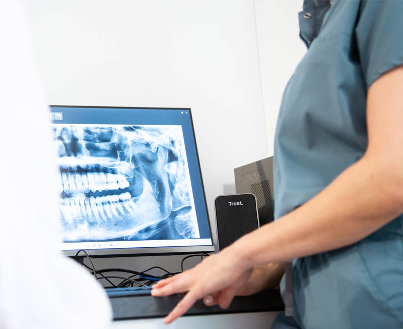 Endodontie Bielefeld